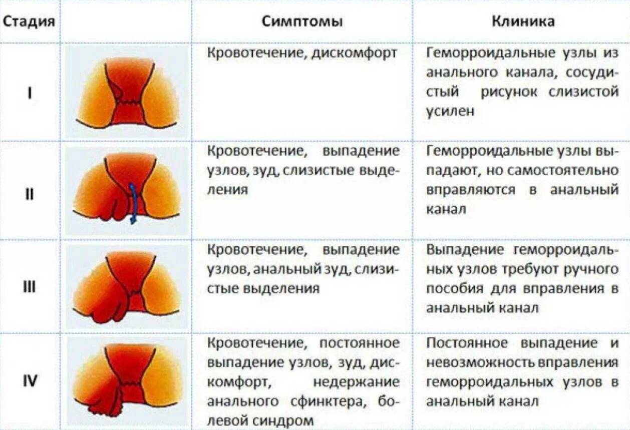 Что делать если идет кровь из попы