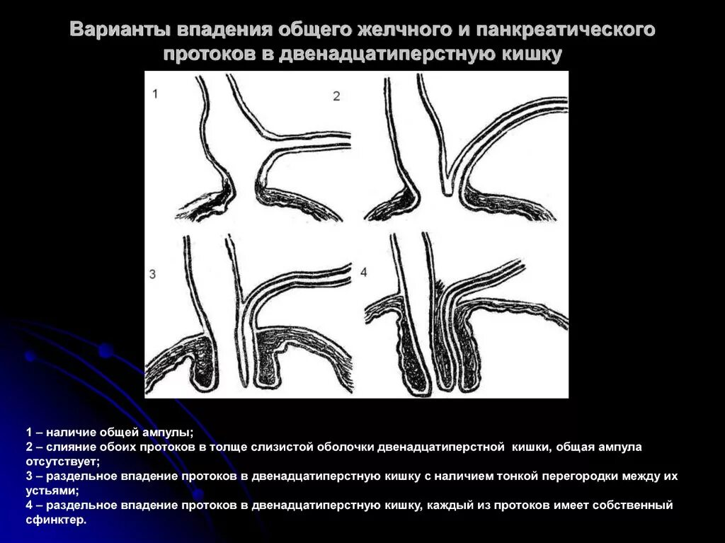 Орган имеет протоки открывающиеся в двенадцатиперстную кишку. Варианты соединения общего желчного и панкреатического протоков. Варианты впадения вирсунгова и желчного протоков в ДПК. Варианты впадения холедоха и панкреатического протоков.