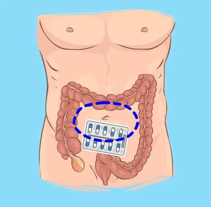 Антибиотики после аппендицита
