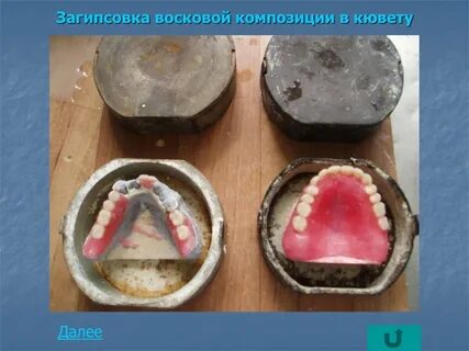Гипсовка в кювету