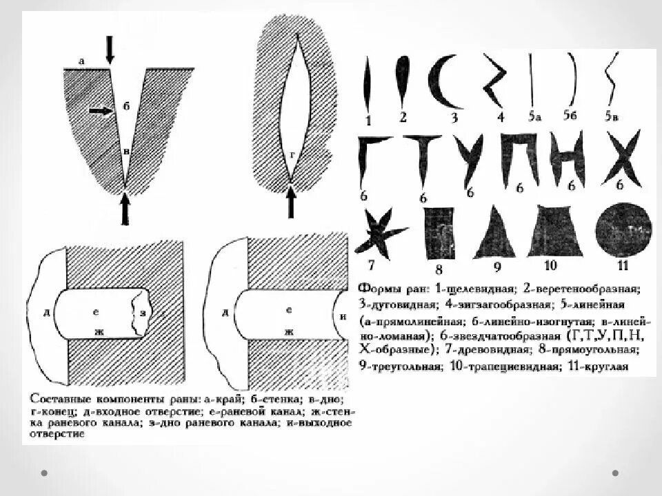 Повреждения твердыми тупыми предметами. Формы колото-резаных ран. веретенообразная форма раны. форма повреждения раны. формы колото резаных повреждений.