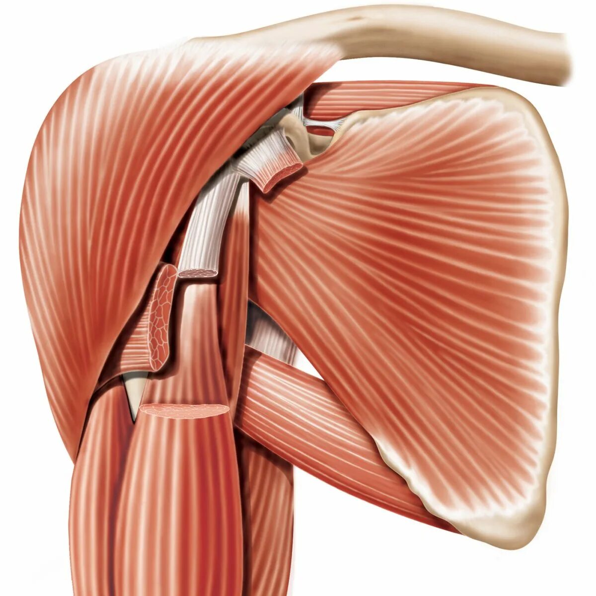 Повреждение сухожилия подлопаточной мышцы. Подлопаточная мышца плеча анатомия. Тендинит двуглавой мышцы плечевого. Сухожилие подлопаточной мышцы. Сухожилие подлопаточной мышцы плеча анатомия.