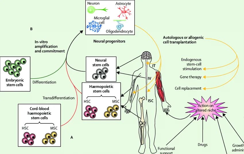 Autologous cell. Стволовые клетки. amyotrophic lateral sclerosis. cell therapy. stem cell therapy in cardiovascular disease diagram.
