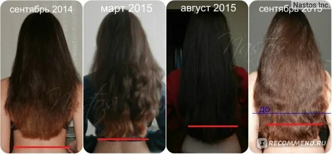 Дарсонваль рост волос до и после Beauty, салон красоты, ул. Зины Портновой, 5, Санкт-Петербург Яндекс Карты