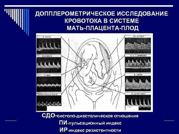 Ультразвуковая допплерография маточно-плацентарного кровотока. Допплерометрия маточно-плацентарно-плодового кровотока. Допплеровское исследование маточно-плацентарного кровотока. Допплерометрическое исследование кровотока плаценты.. Маточная гемодинамика