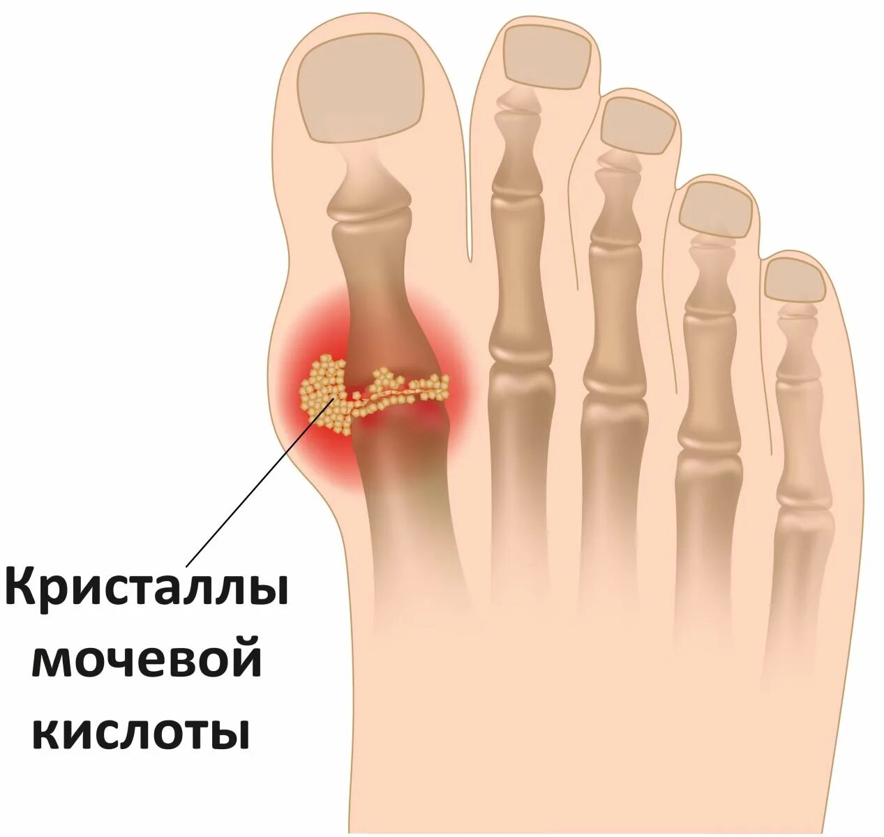 Почему болят фаланги пальцев