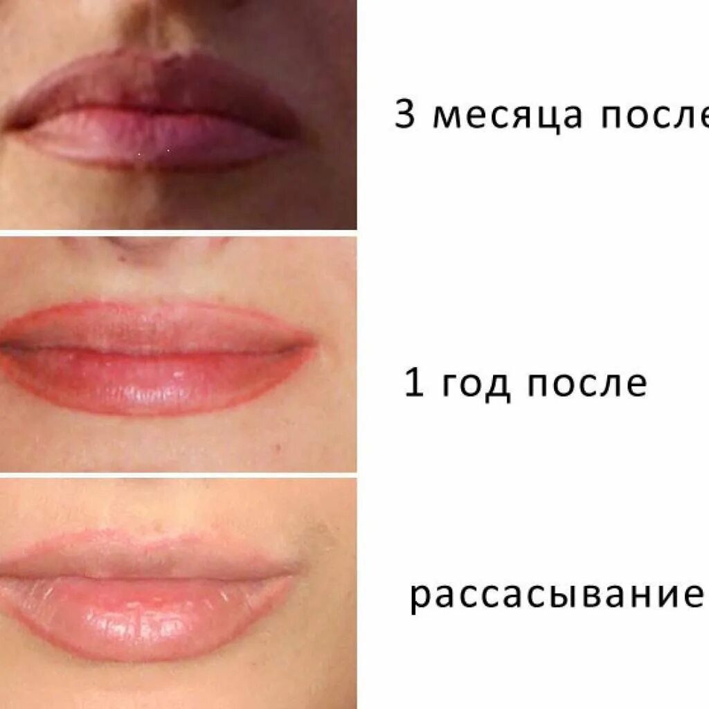 Губы меняющие цвет. Перманентный татуаж губ до и после до и после через месяц. губы после перманентного макияжа. перманентный макияж губ до и после. перманентный макияж губ через год.