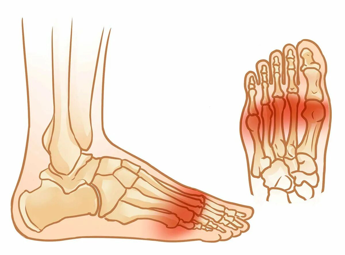 Болит нога кость большая