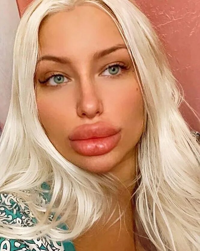 Какие самые большие губы