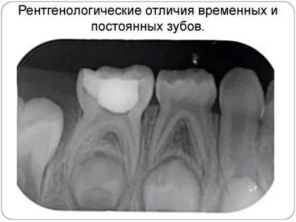 Временные и постоянные зубы