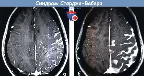 Паркс вебера рубашова