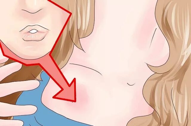 Wikihow картинки косметика. Как быстро сделать засос. Как сделать засос самого себе. Как быстро убрать засос. Как быстро сделать засос.