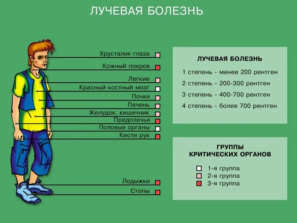 Лучевая болезнь симптомы. Тяжелая форма лучевой болезни. Лучевая болезнь стадии. Группы критических органов