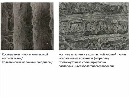 Костные пластинки