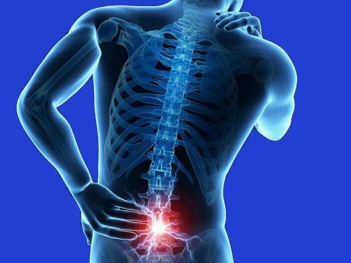 Грудной отдел позвоночника th8-th11. Стеноз позвоночного канала поясничного отдела. Упражнения от защемления нерва под лопаткой. Шейный остеохондроз и спондилез симптомы. Болит спина.