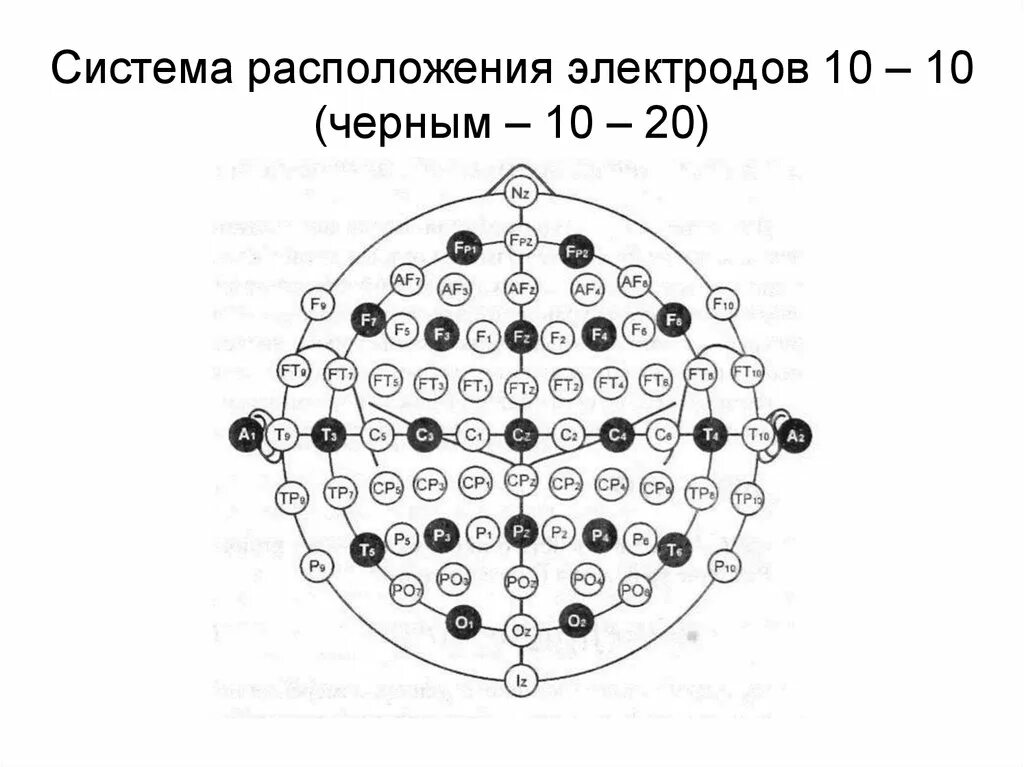 Ээг 10 10. Схема 10-20 наложение электродов. Международная система размещения электродов «10-20». Схема наложения электродов при ЭЭГ 10-20. Схема электродов 10-10.