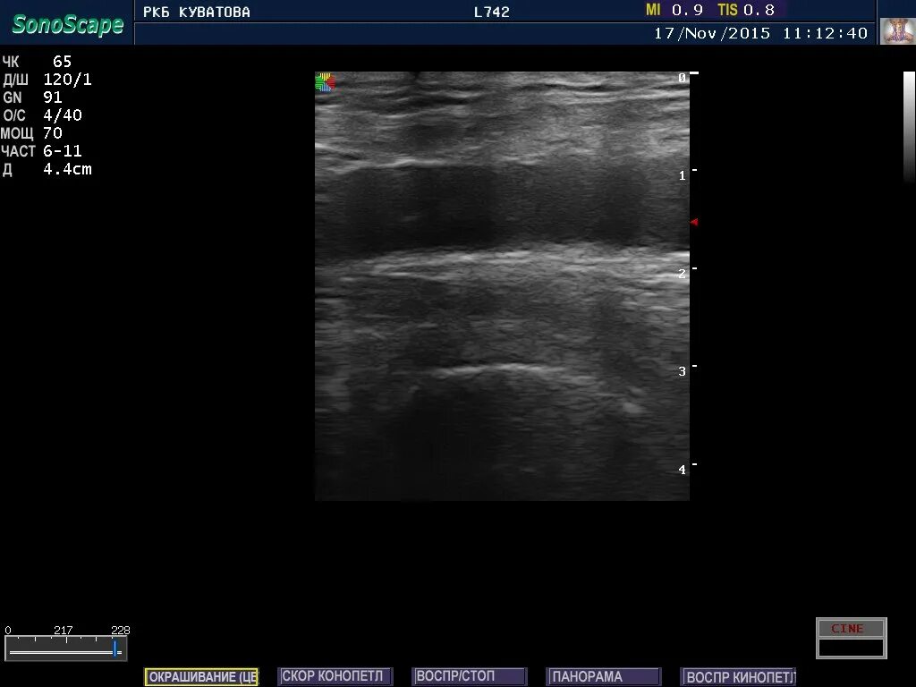 Ультразвуковая допплерография нижних конечностей. Твой доктор митино. Допплерография тюмень. Дуплексное ангиосканирование нижних конечностей. Узи сосудов митино.