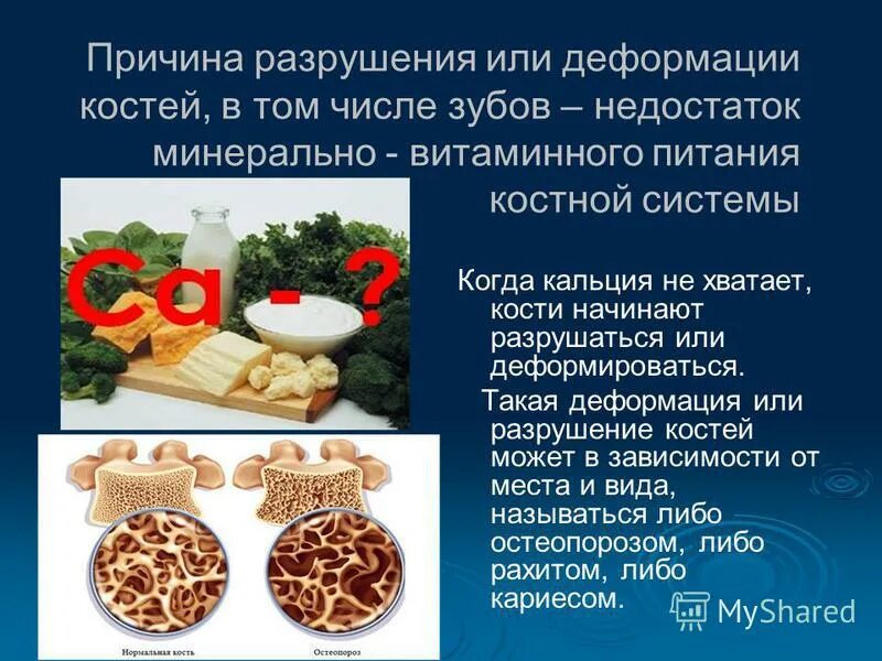 Деформация костей какой витамин. Деформация костей какой витамин