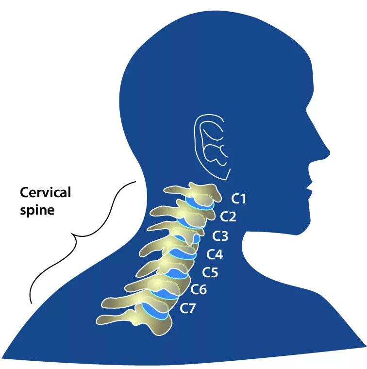Spine дата выхода. Cervical spine. 3 и 4 шейные позвонки. spine 1. персонаж для spine.