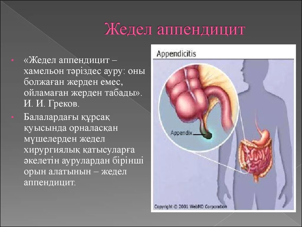 Аппендикс относится. Аппендицит презентация. Аппендикс презентация. Острый простой аппендицит.