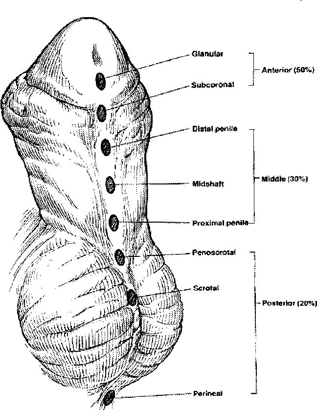 Венечная борозда у мужчин. Продольная борозда сердца анатомия. Венечная борозда на поверхности сердца. Гипоспадия венечная форма. Строение сердца венечная борозда.