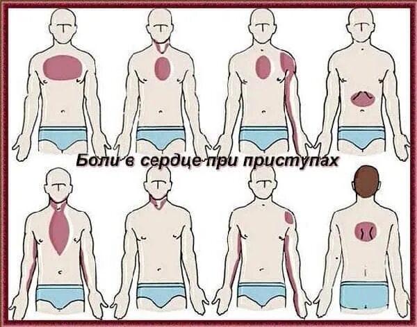 Болит сердце. Болт сердце у подростка. Область сердца у мужчин. Почему болит сердце.