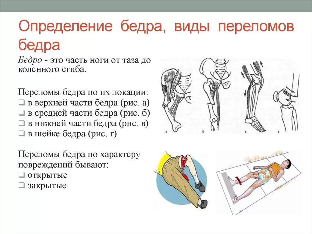 Помощь при открытом переломе бедра. Перелом тазобедренного сустава первая помощь алгоритм. Перелом шейки бедра первая помощь алгоритм действий. Перелом бедра первая помощь алгоритм действий. Алгоритм при переломе бедренной кости.