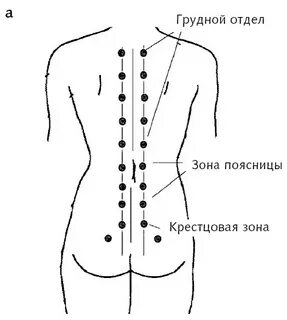 Схема поясницы