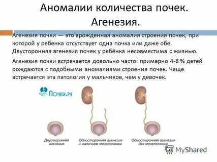 Живут ли без почек