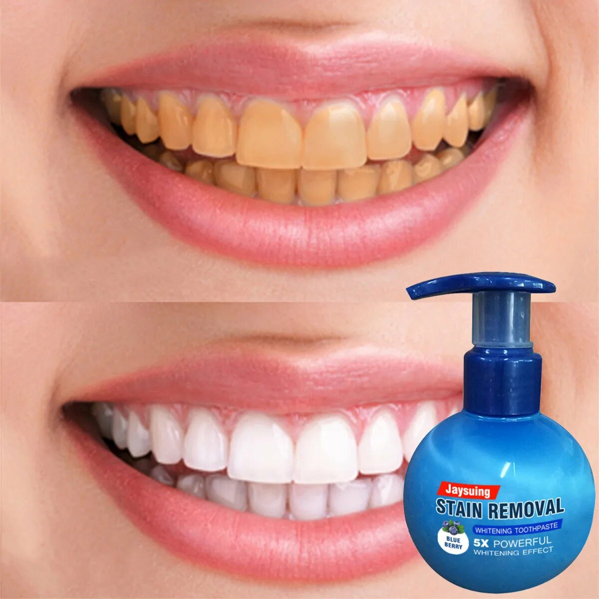 Stain removal паста. Baking Soda Toothpaste зубная паста. Корейская зубная паста Stain removal. Отбеливатель для зубов к зубной пасте.