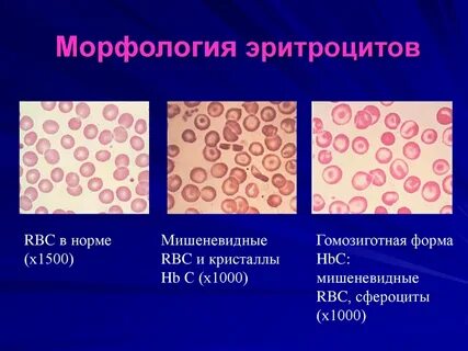 Границы нормы эритроцитов