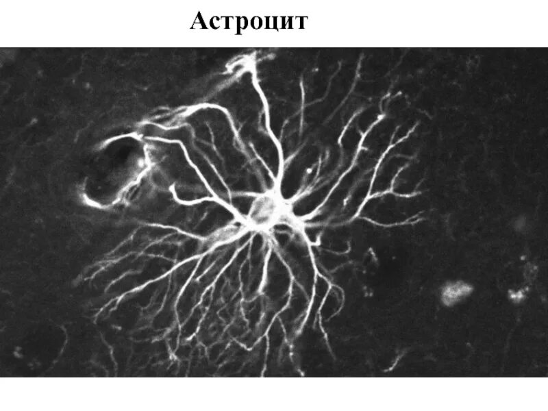 Астроциты гистология. Волокнистые астроциты. Астроцитная глия гистология. Астроцитная глия препарат гистология. Астроцит клиника