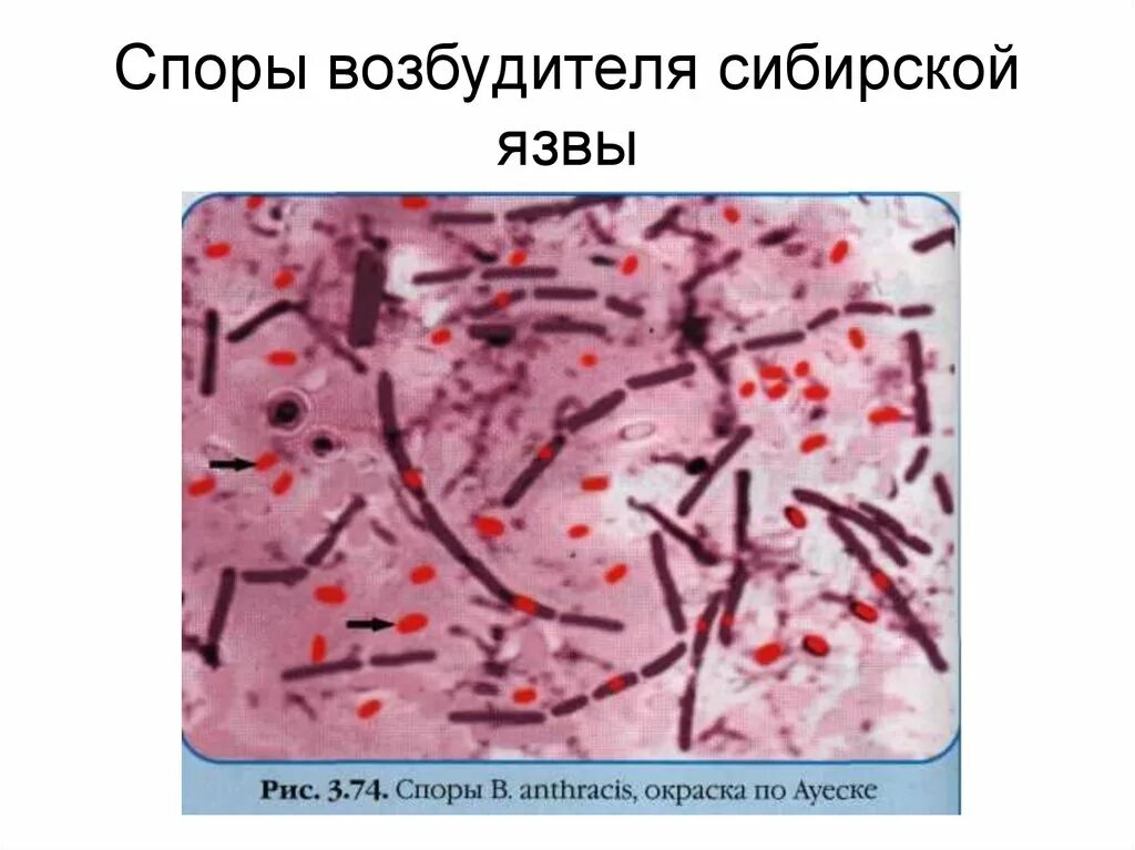Окраска спор бактерий. Бациллы Ожешко. Сибирская язва окраска по Ожешко. Окраска Ожешко Bacillus anthracis. Возбудитель сибирской язвы окраска по Ожешко.