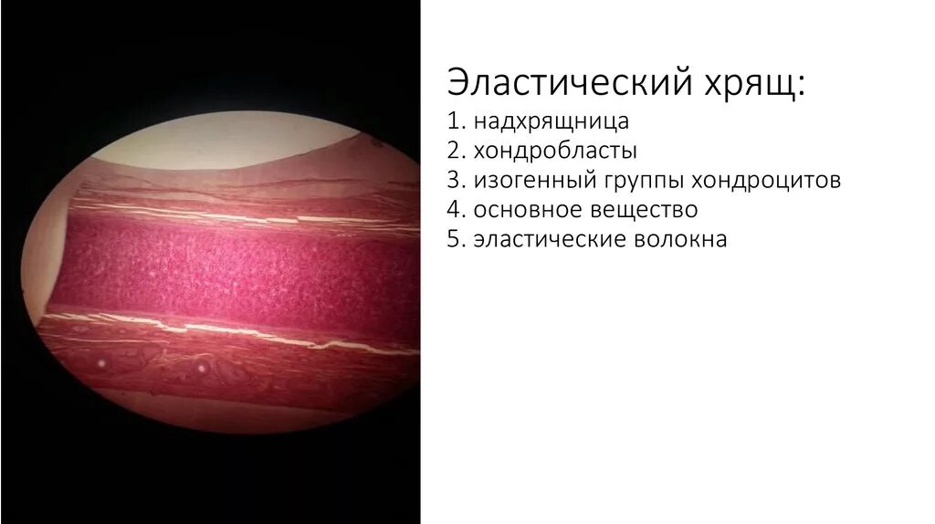 Эластический хрящ гистология препарат. Эластический хрящ ( эластическая хрящевая ткань). изогенные группы эластического хряща. надхрящница эластического хряща. эластический хрящ гистология.