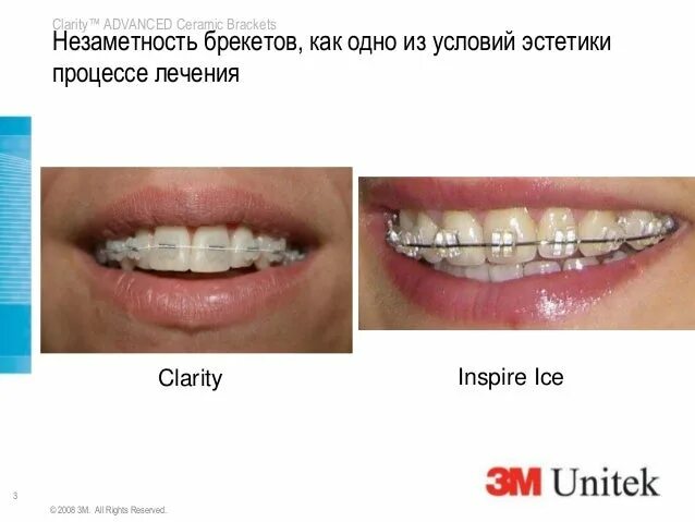 Clarify перевод. Брекет-система 3м Clarity Advance. Керамические брекеты Clarity Advanced, 3m UNITEK, США. Брекеты Кларити адванс. Брекет-система Clarity Advanced + Gemini.