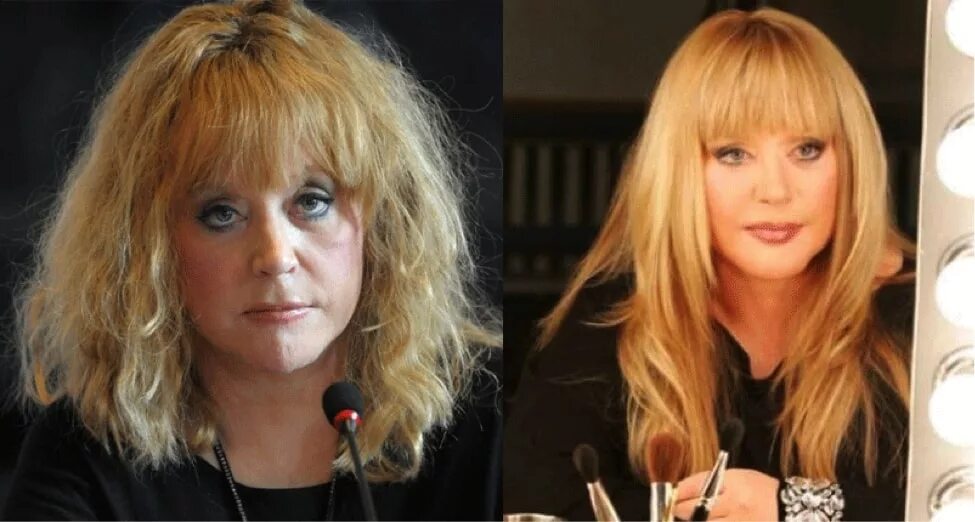 Пугачева 1970. Пластические операции аллы пугачевой. Пугачева после пластической операции. Пугачева до пластики. Пугачева после.