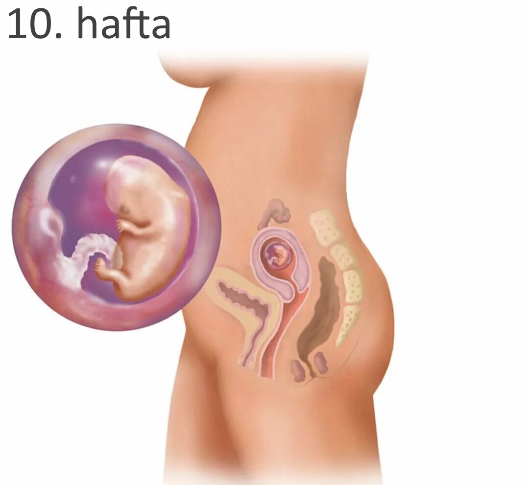 Плод 9-10 недель беременности. Плод на 9 неделе беременности. Почему на 10 неделе беременности