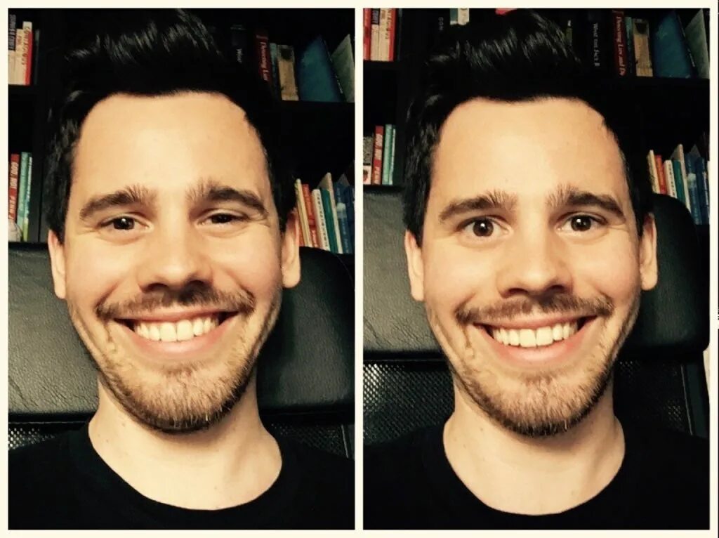 Example smile