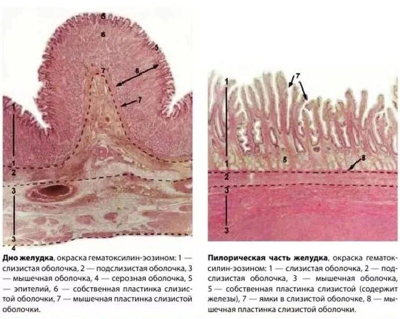 Проникать в слизистую оболочку. Фундальный отдел желудка гистология препарат. Слизистая оболочка желудка гистология препарат. Дно желудка препарат гистология. Строение дна желудка гистология препарат.