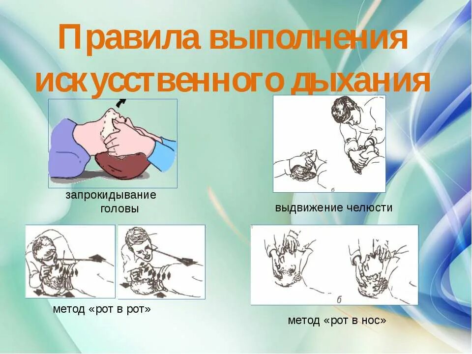 Техника проведения искусственного дыхания. Действия при выполнении искусственного дыхания. Порядок выполнения искусственного. Искусственное дыхание и непрямой (наружный) массаж сердца. Порядок непрямого массажа сердца и искусственного дыхания.