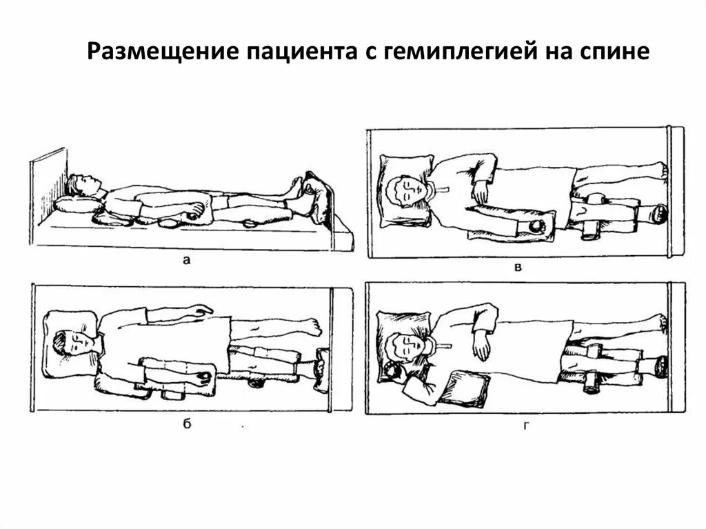 Размещение пациента в постели алгоритм. Размещение пациента с гемиплегией в положение фаулера. размещение пациента с гемиплегией в положение лежа на спине. размещение пациента с гемиплегией в положение на спине. размещение пациента с гемиплегией в положение на животе.