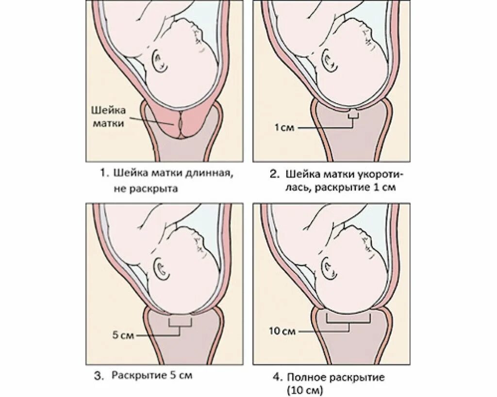 Раскрытие шейки матки перед родами. Шейка при родах сколько
