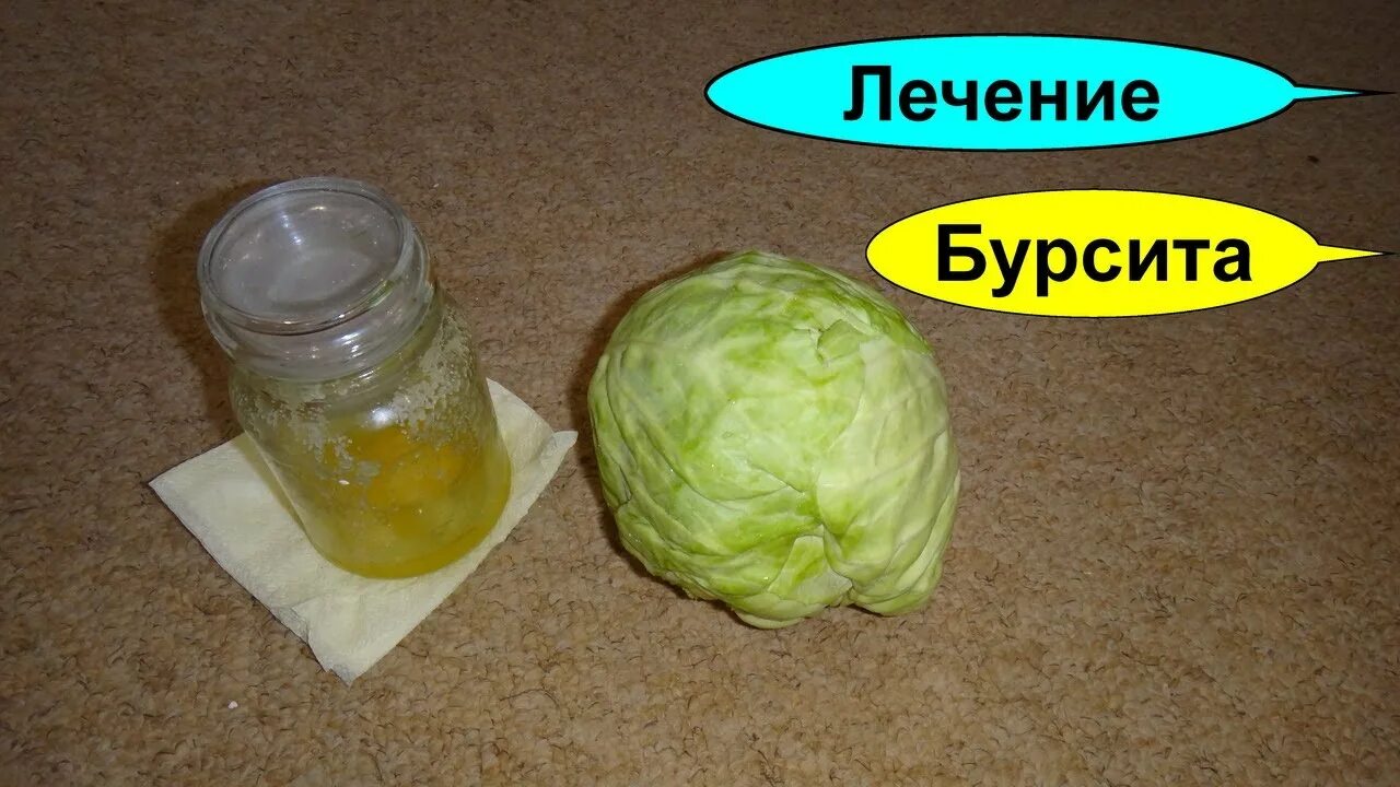 Капустный лист при болях в суставах. Капуста и мед компресс для суставов. капустный лист при бурсите. лечение суставов капустным листом.