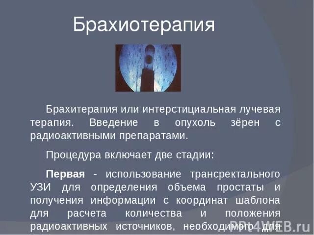 Простата после облучения. Контактная лучевая терапия брахитерапия это. Брахитерапия предстательной железы. Мрт после брахитерапии простаты. Брахитерапия предстательной железы на кт.