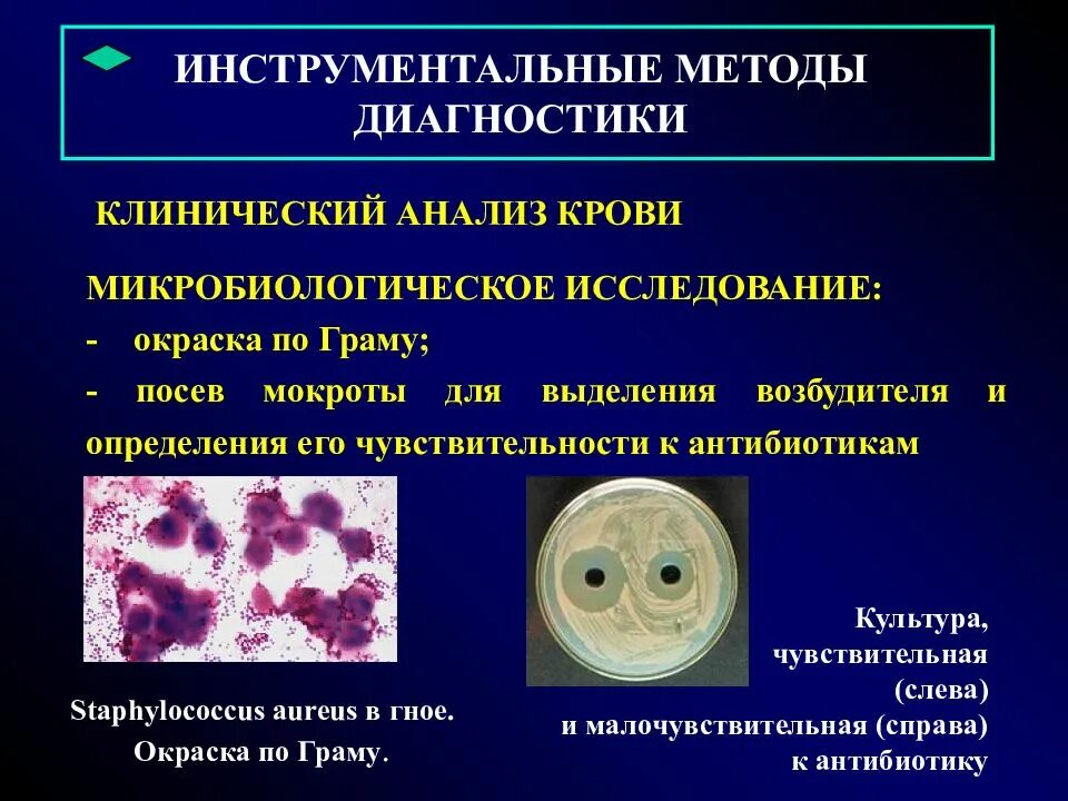 Клинические методы диагностики. Микробиологическое исследование мокроты. материал для микробиологических исследований воспаление легких. инструментальные методы диагностики кровотечения. общеклиническое исследование мокроты.