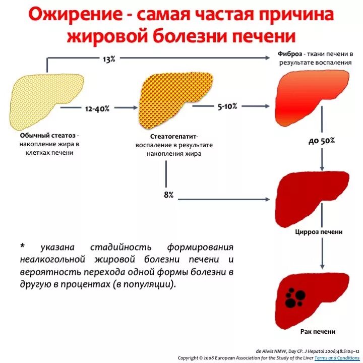 Желчный ожирение