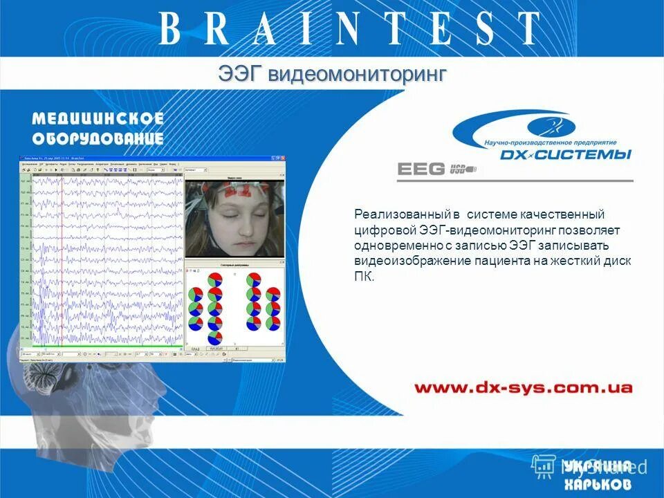 Ээг ульяновск. ЭЭГ видеомониторинг. Заключение ЭЭГ видеомониторинг. Центр ЭГГ видео мориторинга. ЭЭГ видеомониторинг детское.