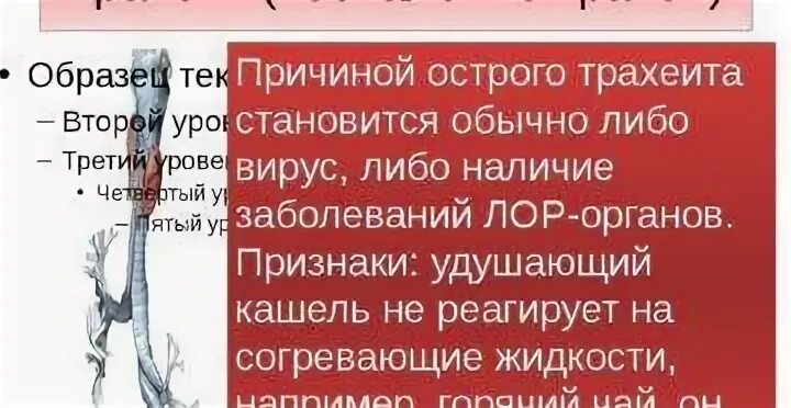 Трахеит эффективное лечение. Острый трахеит симптомы у детей.