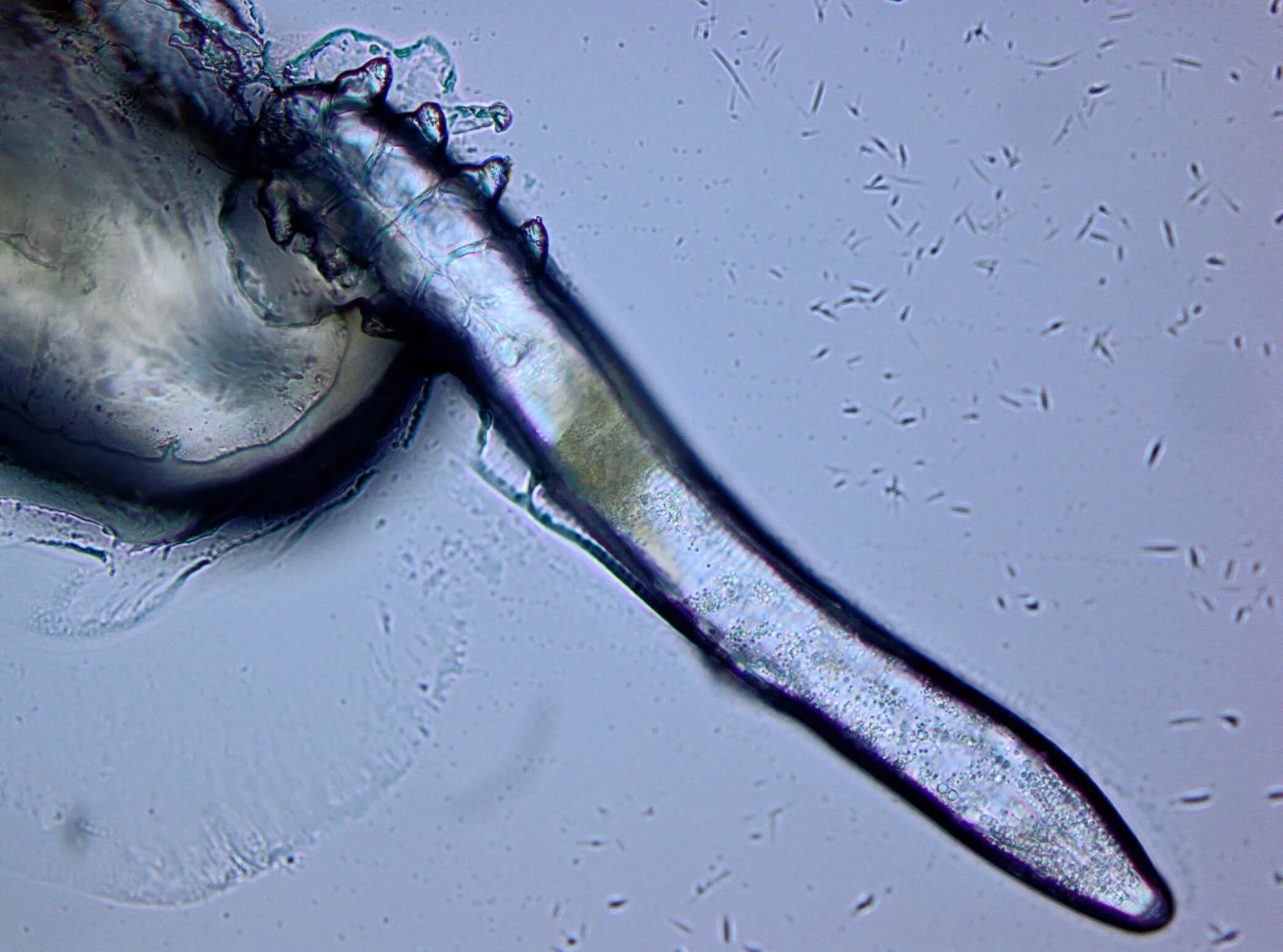 Демодекс микроскоп. Демодекс железница угревая. demodex canis. demodex brevis под микроскопом.