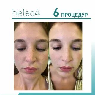 Heleo4 отзывы